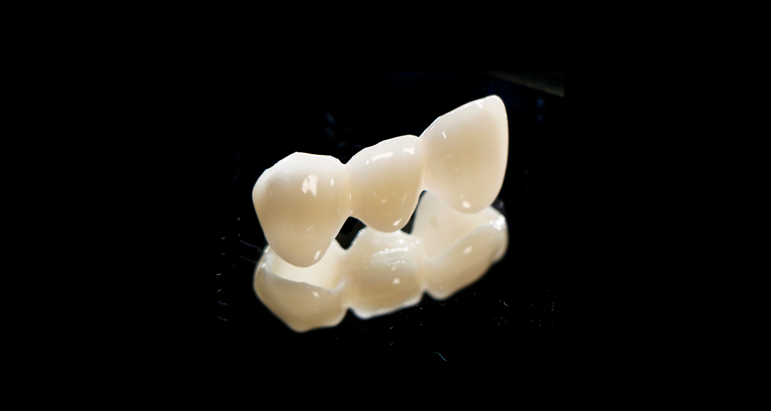 Zirconia from A to Z（2）