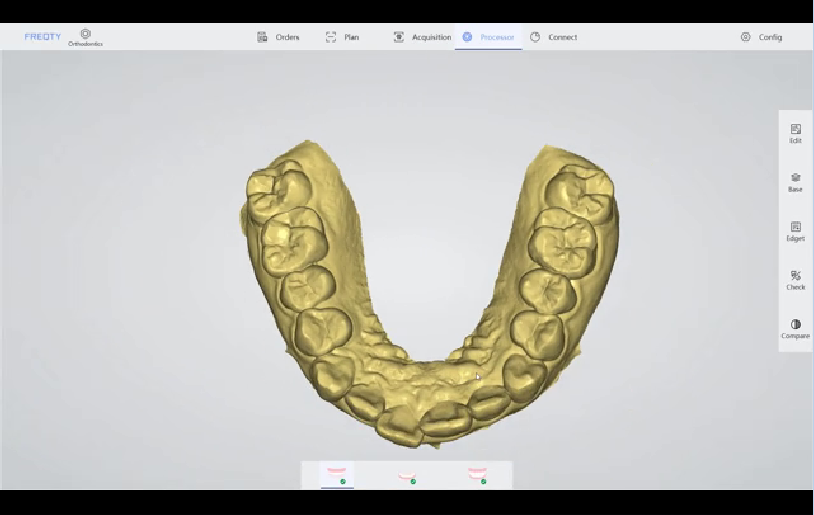 What is intraoral scanner？