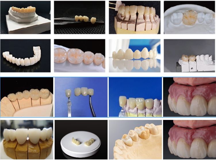 Dental Multilayer Zirconia Block