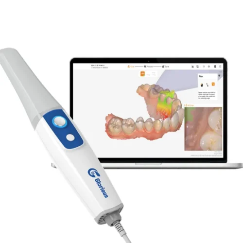 scanner intraoral odontológico